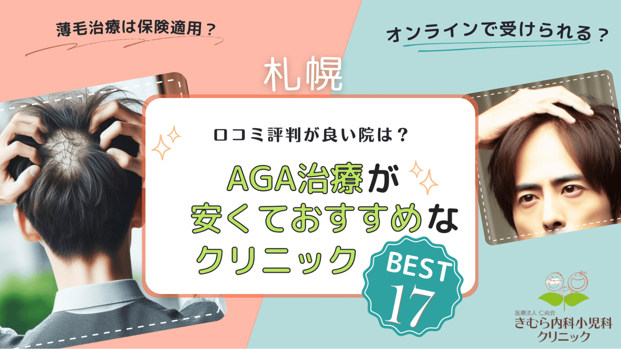 札幌のAGA治療おすすめクリニック17選！